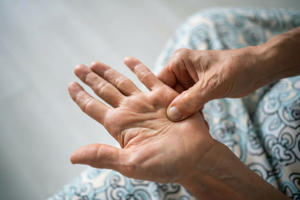 Dupuytren’s contracture hand condition treatment with gentle radiotherapy at TheraLife Clinics UK